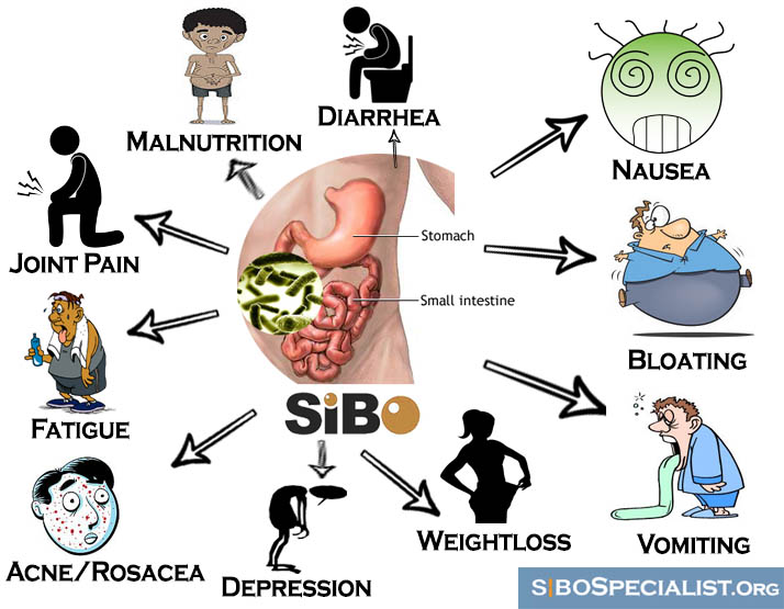 sibo-signs-symptoms-chart