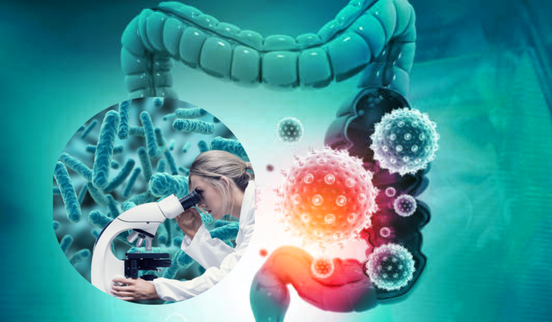 diagnosis of sibo