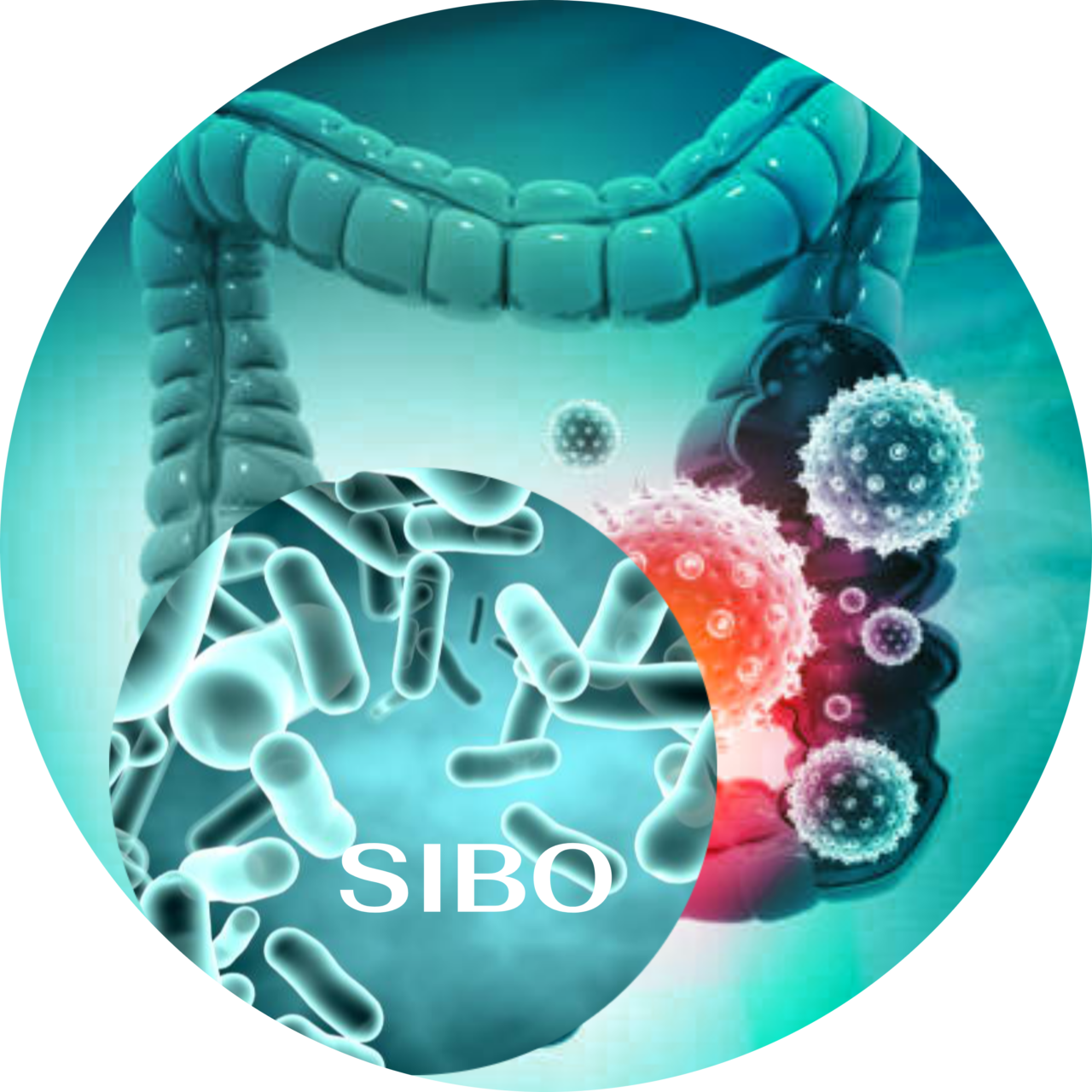 5 facts about SIBO – OrganiClinic